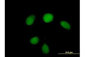 Immunofluorescence of purified MaxPab antibody to HUS1 on HeLa cell. (HUS1 anticorps  (AA 1-280))