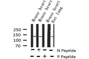 Western blot analysis of Phospho-Abl (Tyr412) expression in various lysates (ABL1 anticorps  (pTyr412))
