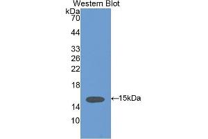 Western Blotting (WB) image for anti-Vinculin (VCL) (AA 1020-1134) antibody (ABIN1175095) (Vinculin anticorps  (AA 1020-1134))