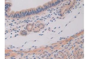 Detection of IL11Ra in Mouse Uterus Tissue using Polyclonal Antibody to Interleukin 11 Receptor Alpha (IL11Ra) (IL11RA anticorps  (AA 194-329))