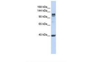 Image no. 1 for anti-Regulatory Factor X, 1 (Influences HLA Class II Expression) (RFX1) (C-Term) antibody (ABIN6739091)