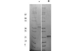 SDS-PAGE of Rat Vascular Endothelial Growth Factor-165 Recombinant Protein SDS-PAGE of Rat Vascular Endothelial Growth Factor-165 Recombinant Protein. (VEGF 165 Protéine)