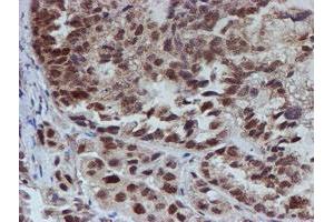 Image no. 1 for anti-ATR Interacting Protein (ATRIP) (AA 42-309) antibody (ABIN1491507)