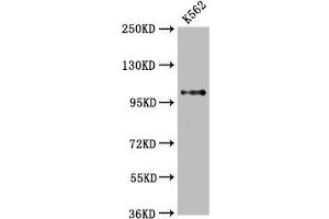 Western Blot Positive WB detected in: K562 whole cell lysate All lanes: DGCR8 antibody at 2. (Recombinant DGCR8 anticorps)