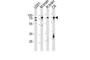 Western Blotting (WB) image for anti-Far Upstream Element (FUSE) Binding Protein 1 (FUBP1) antibody (ABIN2997751) (FUBP1 anticorps)