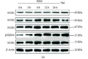 Earle's balanced salt solution (EBSS) increases NADPH oxidative activity and ROS generation in ARPE-19 cells in a time-dependent manner.