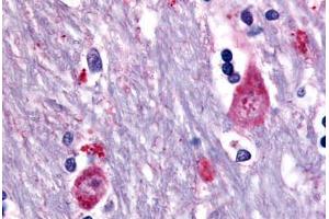 Human Brain, Caudate (formalin-fixed, paraffin-embedded) stained with CHRM3 antibody ABIN213499 at 10 ug/ml followed by biotinylated goat anti-rabbit IgG secondary antibody ABIN481713, alkaline phosphatase-streptavidin and chromogen.