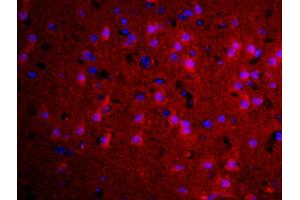 Formalin-fixed and paraffin embedded rat brain labeled with Rabbit Anti-TGM2 Polyclonal Antibody, Unconjugated used at 1:200 dilution for 40 minutes at 37°C