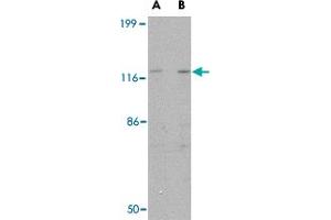 Western blot analysis of SLITRK3 in SK-N-SH cell lysate with SLITRK3 polyclonal antibody  at (A) 0. (SLITRK3 anticorps  (C-Term))