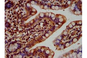 anti-Kinectin 1 (Kinesin Receptor) (KTN1) (AA 978-1116) antibody