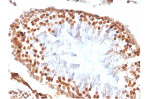 Formalin-fixed, paraffin-embedded Rat Testis stained with Wilm's Tumor Rabbit Recombinant Monoclonal Antibody (WT1/1434R). (Recombinant WT1 anticorps)