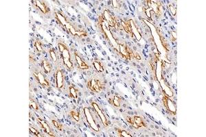 Immunohistochemistry of paraffin embedded mouse kidney using ADCY4 (ABIN7072959) at dilution of 1: 700 (400x lens) (ADCY4 anticorps)