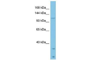 Laminin Beta 3 antibody used at 1 ug/ml to detect target protein. (Laminin beta 3 anticorps  (Middle Region))