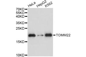 Western blot analysis of extracts of various cell lines, using TOMM22 antibody. (TOMM22 anticorps)