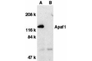 Western Blotting (WB) image for anti-Apoptotic Peptidase Activating Factor 1 (APAF1) (C-Term) antibody (ABIN1030242) (APAF1 anticorps  (C-Term))