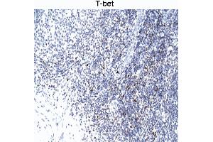 T-bet staining of human tonsil.