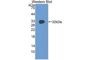 Detection of Recombinant TF, Mouse using Monoclonal Antibody to Tissue Factor (TF)