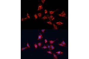 Immunofluorescence analysis of C6 cells using  antibody (ABIN7265433) at dilution of 1:100.