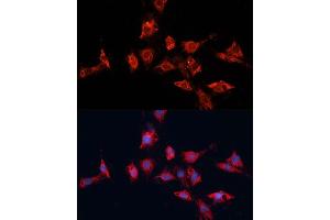 Immunofluorescence analysis of C6 cells using  antibody (ABIN7265433) at dilution of 1:100. (ADAM11 anticorps  (AA 290-430))