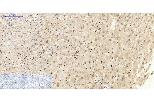 Immunohistochemistry of paraffin-embedded Human liver tissue using NFκB-p105/p50 Polyclonal Antibody at dilution of 1:200. (NFKB1 anticorps)