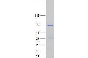 Validation with Western Blot