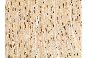 ABIN6258822 and ABIN6274418 at 1/100 staining Rat heart tissue by IHC-P. (MAP4K3 anticorps  (N-Term))