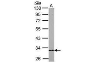Image no. 3 for anti-3-hydroxyisobutyrate Dehydrogenase (HIBADH) (AA 1-257) antibody (ABIN1501919)