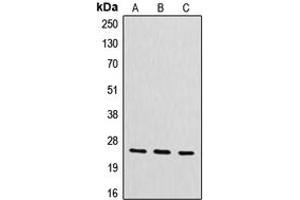 Western blot analysis of CYB561D2 expression in HeLa (A), mouse liver (B), rat kidney (C) whole cell lysates. (CYB561D2 anticorps  (Center))