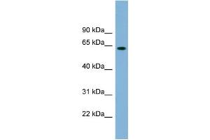 WB Suggested Anti-SLFN12 Antibody Titration: 0. (SLFN12 anticorps  (Middle Region))
