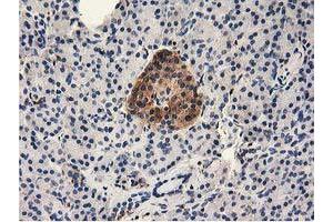 Immunohistochemical staining of paraffin-embedded Human pancreas tissue using anti-MICAL1 mouse monoclonal antibody. (MICAL1 anticorps)