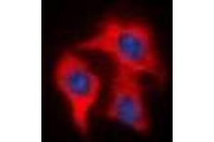 Immunofluorescent analysis of FAP alpha staining in HeLa cells. (FAP anticorps)