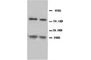 Western blot analysis of rat thymus tissue lysis using NIP3 antibody (BNIP3 anticorps  (C-Term))