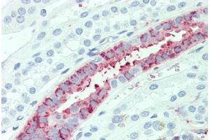 Anti-SLC4A2 antibody  ABIN1049340 IHC staining of human kidney. (SLC4A2 anticorps  (N-Term))