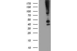Western Blotting (WB) image for anti-serpin Peptidase Inhibitor, Clade B (Ovalbumin), Member 13 (SERPINB13) antibody (ABIN1500878) (SERPINB13 anticorps)