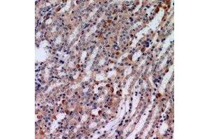 Immunohistochemical analysis of Tensin 3 staining in human kindey formalin fixed paraffin embedded tissue section. (TNS3 anticorps)