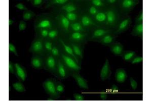 Immunofluorescence of monoclonal antibody to STK4 on HeLa cell. (STK4 anticorps  (AA 391-485))
