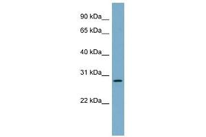 DNAJB9 antibody used at 1 ug/ml to detect target protein. (DNAJB9 anticorps)