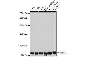 Western blot analysis of extracts of various cell lines using FREM1 Polyclonal Antibody at dilution of 1:1000. (FREM1 anticorps)