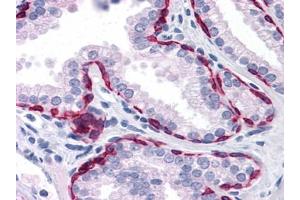 Immunohistochemistry (IHC) image for anti-Keratin 81 (KRT81) (AA 1-203) antibody (ABIN614629)