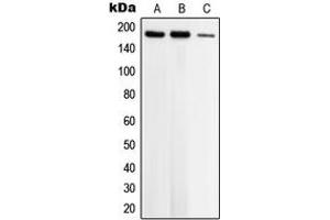 Western blot analysis of Topoisomerase 2 beta expression in K562 (A), Jurkat (B), MCF7 (C) whole cell lysates.