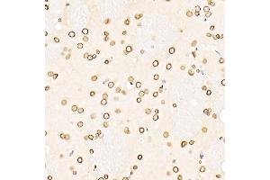 Immunohistochemistry of paraffin-embedded rat brain using Lamin B1 Rabbit pAb (ABIN3015697, ABIN3015698, ABIN3015699, ABIN1680700 and ABIN6219049) at dilution of 1:250 (40x lens).
