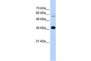 P4HB antibody used at 0. (P4HB anticorps  (N-Term))