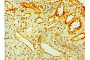 Immunohistochemistry of paraffin-embedded human kidney tissue using ABIN7149303 at dilution of 1:100 (CISH anticorps  (AA 1-257))