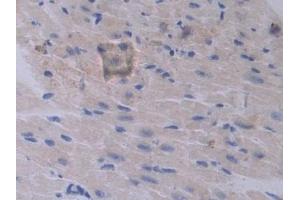 Detection of PCSK1 in Mouse Heart Tissue using Polyclonal Antibody to Proprotein Convertase Subtilisin/Kexin Type 1 (PCSK1)