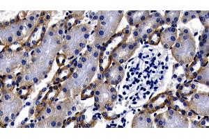 Detection of MyD88 in Mouse Kidney Tissue using Polyclonal Antibody to Myeloid Differentiation Factor 88 (MyD88) (MYD88 anticorps  (AA 1-296))