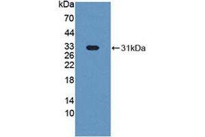 Detection of Recombinant HABP1, Bovine using Polyclonal Antibody to Complement component 1 Q subcomponent-binding protein, mitochondrial (C1QBP)