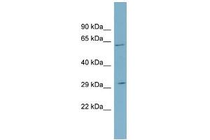 WB Suggested Anti-SRD5A2 Antibody Titration:  0. (SRD5A2 anticorps  (N-Term))