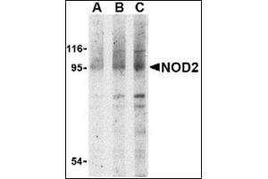 Western blot analysis of NOD2 in Jurkat cell lysate with this product at (A) 1, (B) 2 and (C) 4 μg/ml. (NOD2 anticorps  (N-Term))