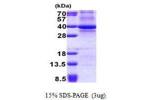 SDS-PAGE (SDS) image for Cyclin-Dependent Kinase 3 (CDK3) (AA 1-305) protein (His tag) (ABIN5853044)