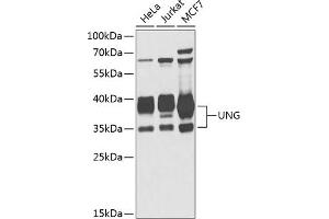 Western blot analysis of extracts of various cell lines, using UNG antibody (ABIN6133476, ABIN6149934, ABIN6149936 and ABIN6216305) at 1:1000 dilution. (UNG anticorps  (AA 1-313))
